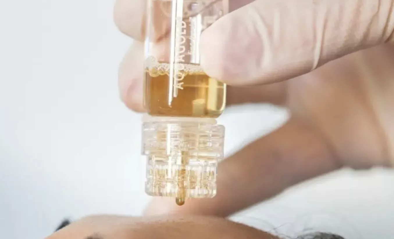 Aqua Gold Fine Touch ist eine exklusive, nadelfreundliche Mikroinfusions-Behandlung